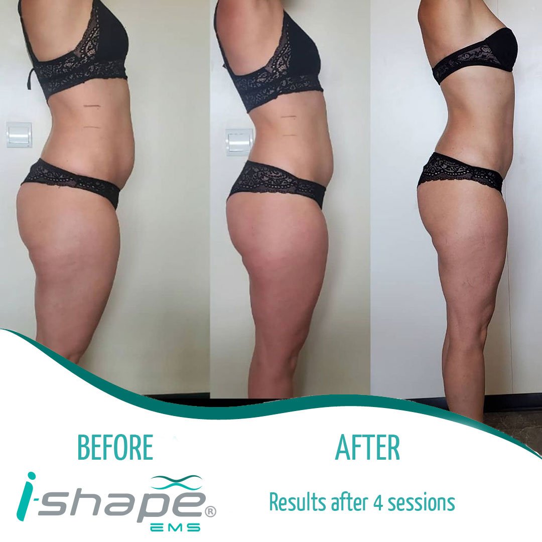 i-Shape results